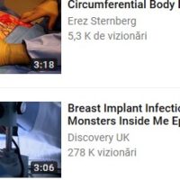 Recuperarea de dupa operatia de marire a sanilor